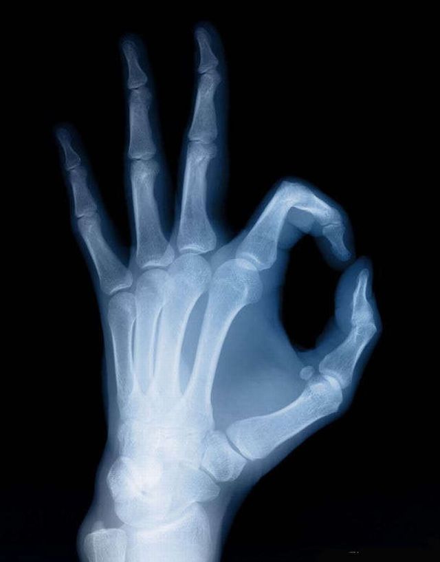 tapete für herren telefon,radiographie,medizinische radiographie,radiologie,hand,medizinische bildgebung