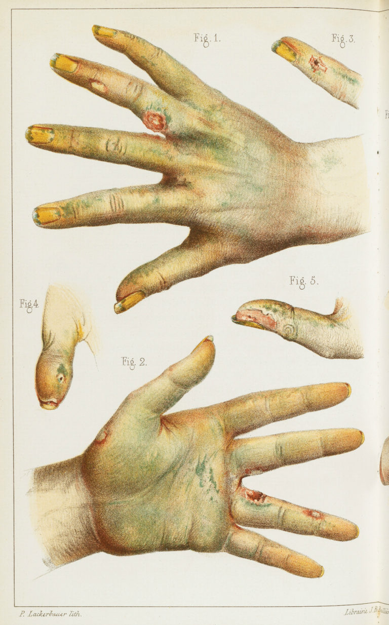 carta da parati dell'arsenico,mano,chiodo,linguaggio dei segni,gesto,carne