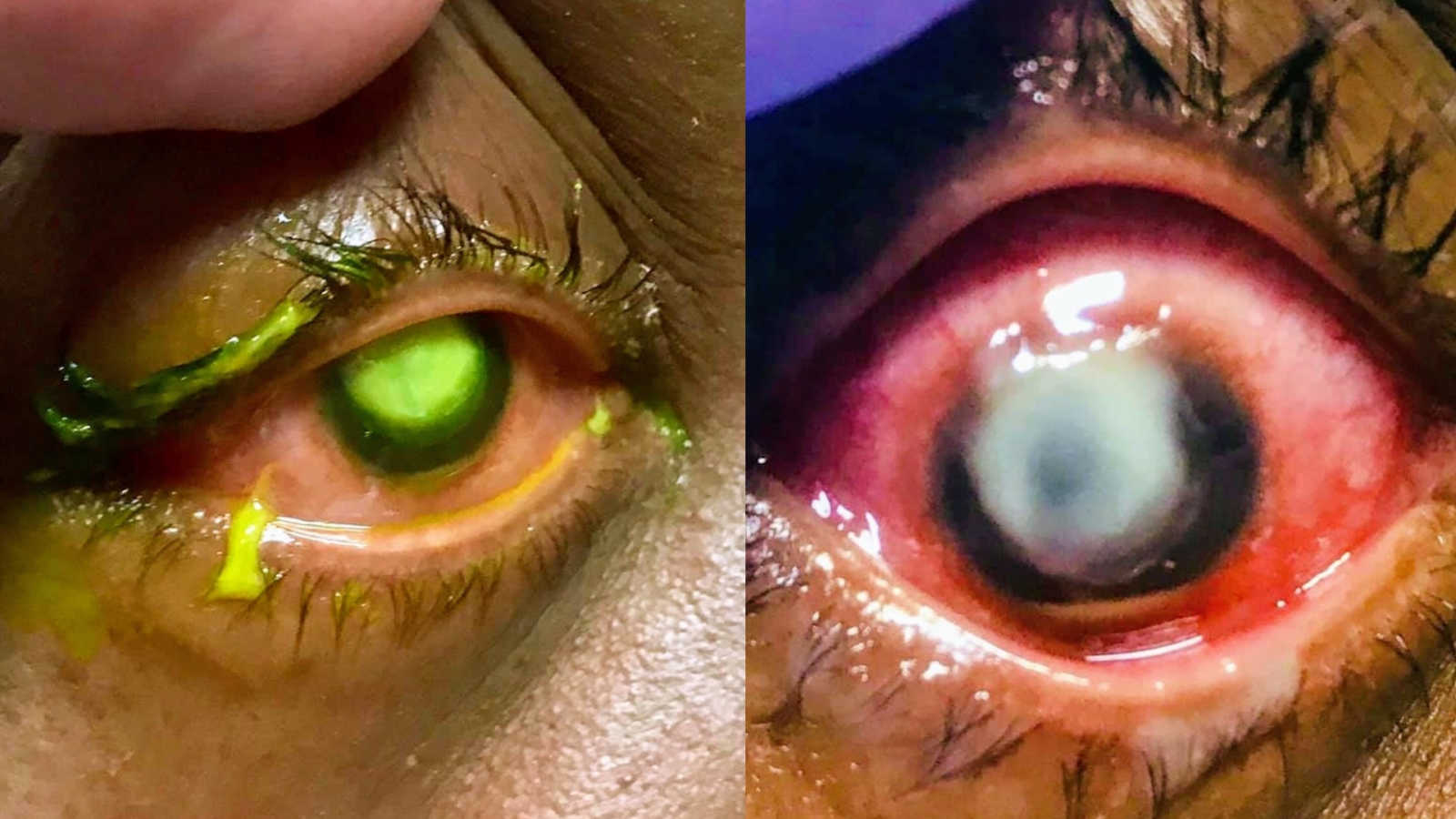 fondo de pantalla de contactos,ojo,iris,de cerca,verde,ceja